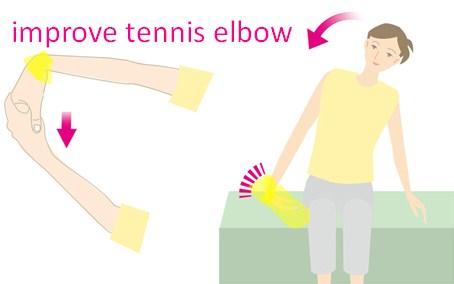 improve tennis elbow improve tennis elbow