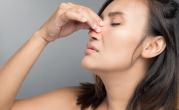 10 Ways To Deal With Deviated Nasal Septum